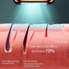 IPL-Laser-Haarentfernung IPL-Laser-Haarentfernung